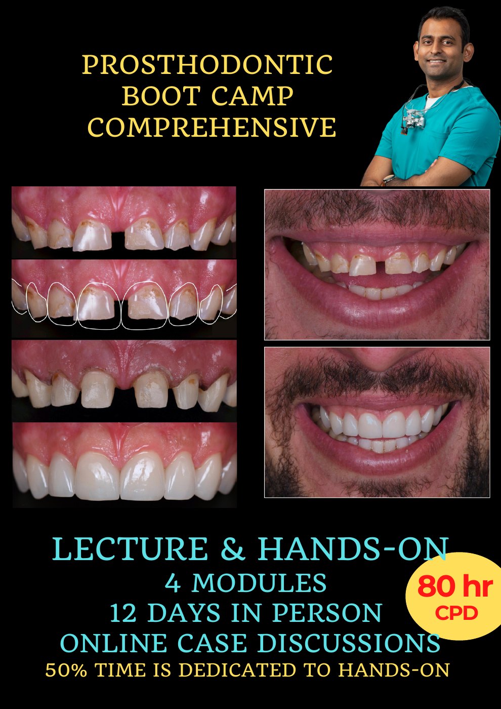 First page of the Comprehensive Prosthodontic Boot Camp course poster