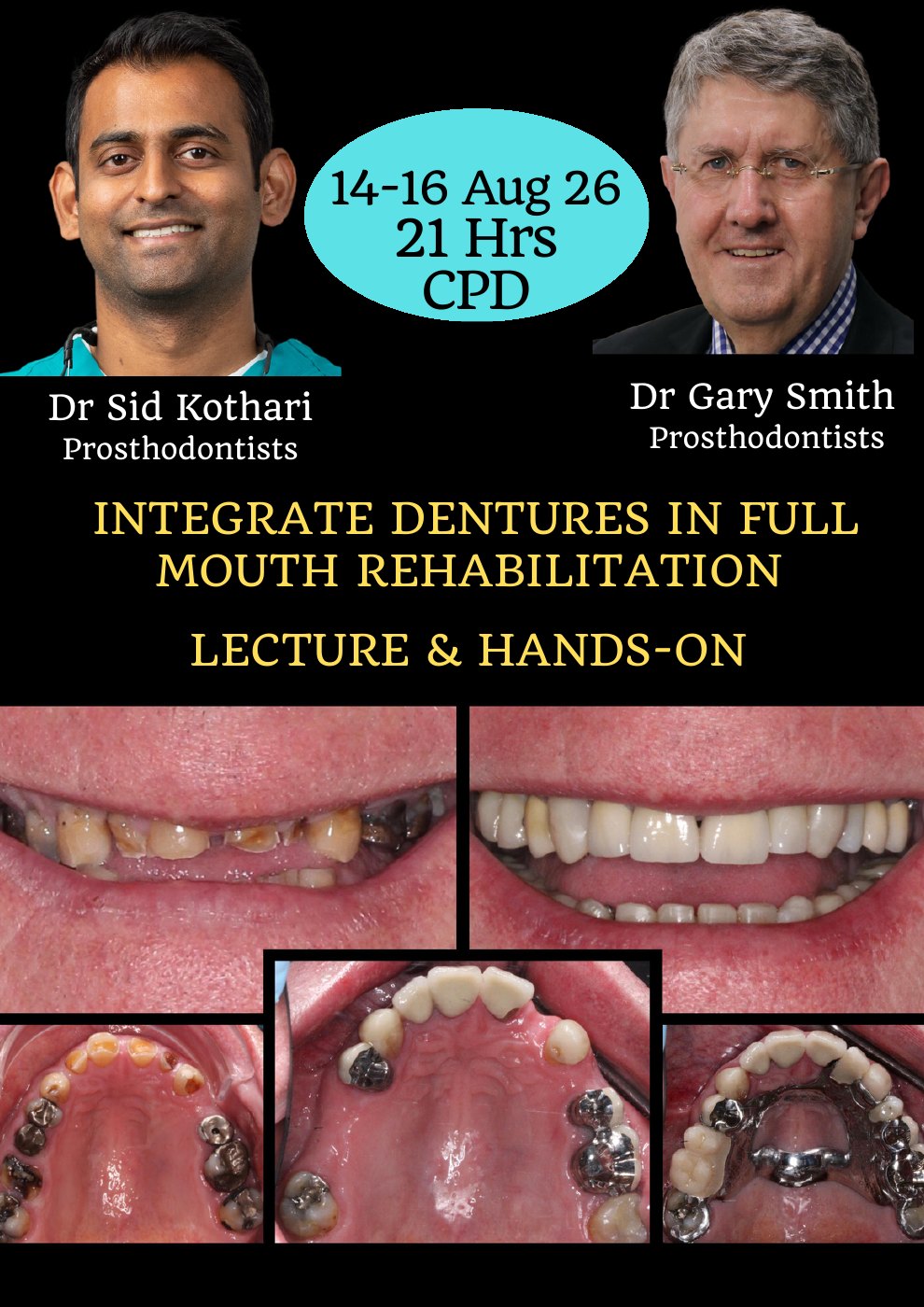 First page of the Removable Prosthodontics course poster