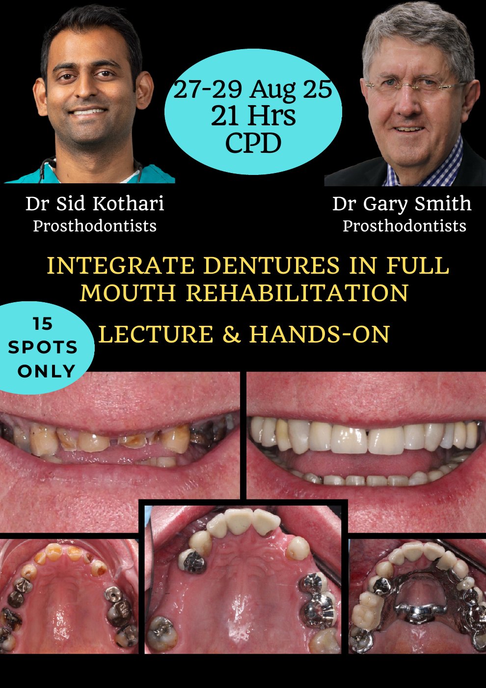 First page of the Removable Prosthodontics course poster